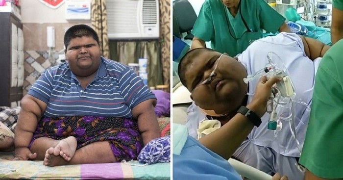 Самый толстый подросток в мире сбросил почти 64 кг
