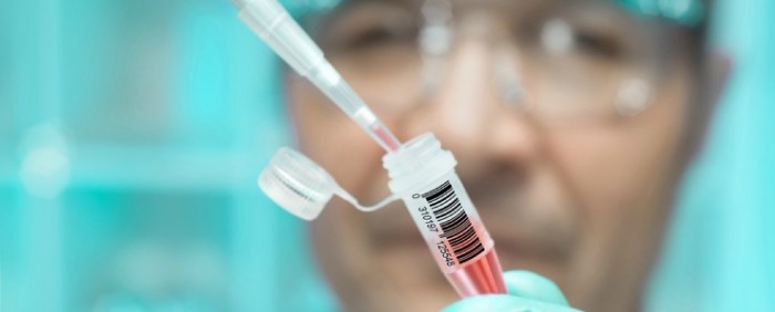 Вакцина от ВИЧ прошла ключевые тесты, её готовят к клиническим испытаниям