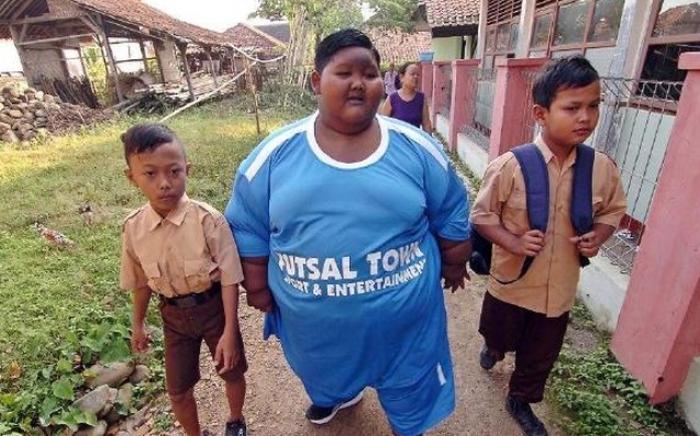 12-летний индонезийский подросток Арья Пермана похудел на 95 килограмм