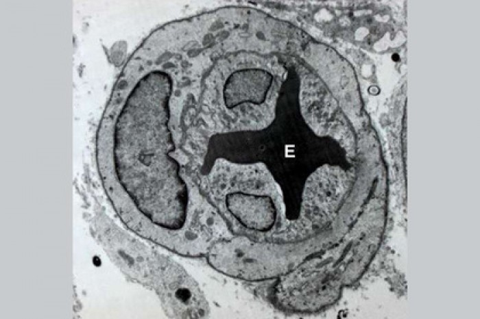 Найдено средство омоложения сердца и сосудов