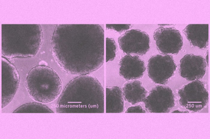 Выращен недоразвитый мозг неандертальца