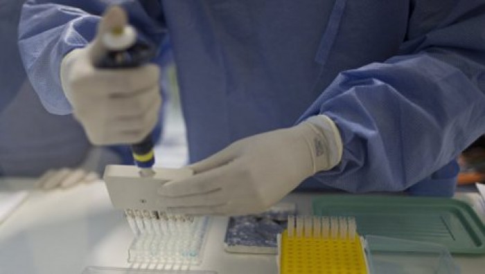 Ученые: Новый смертельный вирус CladeX может спровоцировать эпидемию мирового масштаба