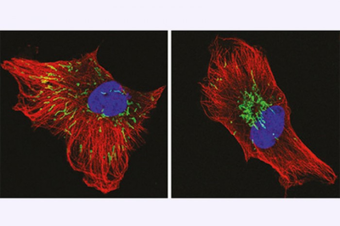 Найден новый способ борьбы с неизлечимым раком