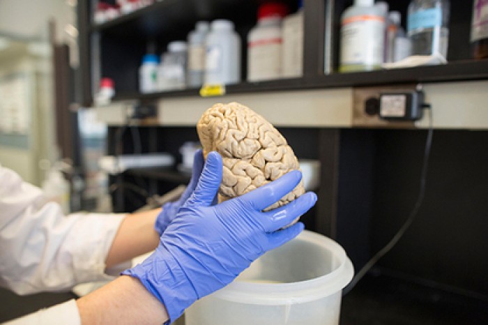 Разгадана столетняя тайна мозга