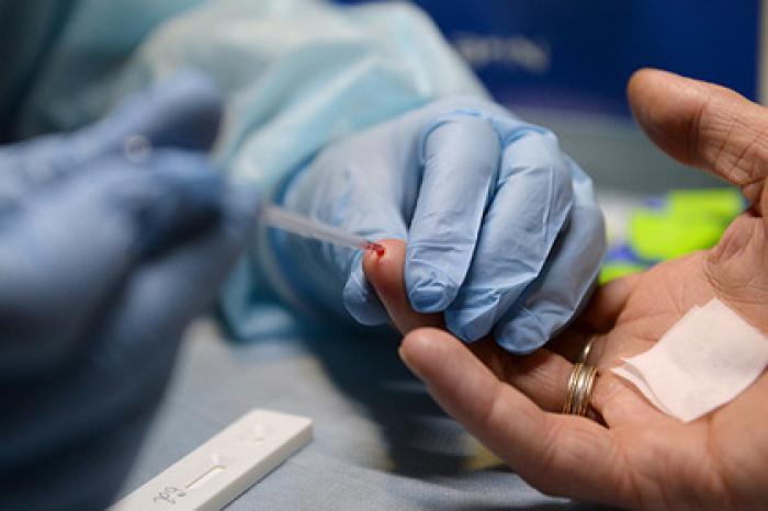 Россияне стали меньше бояться ВИЧ-положительных