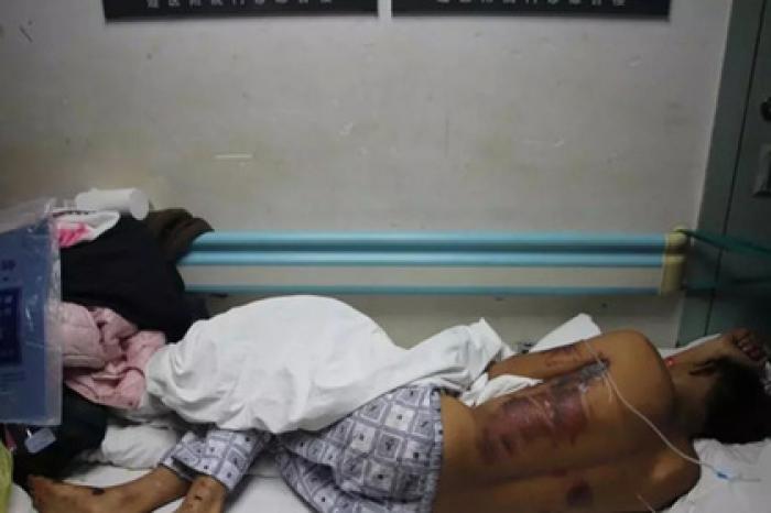 Жених попытался сбежать от пыток на свадьбе и попал под машину