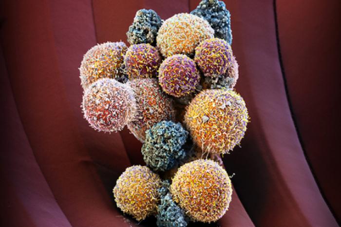 Найден способ побороть неизлечимый рак