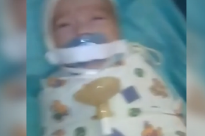 Врачи объяснили видео младенца с заклеенным ртом