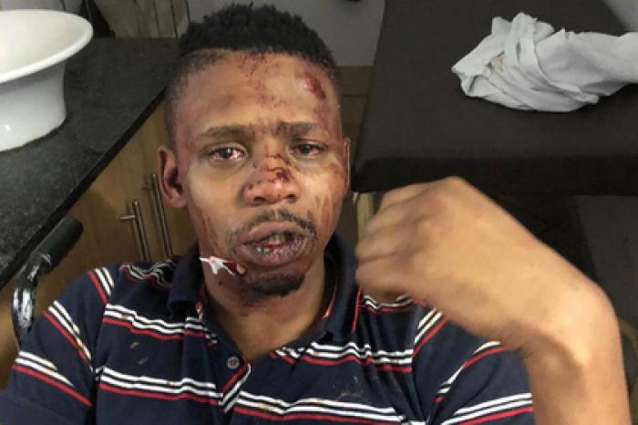 Чернокожий ведущий вызвался помочь незнакомцам и был избит