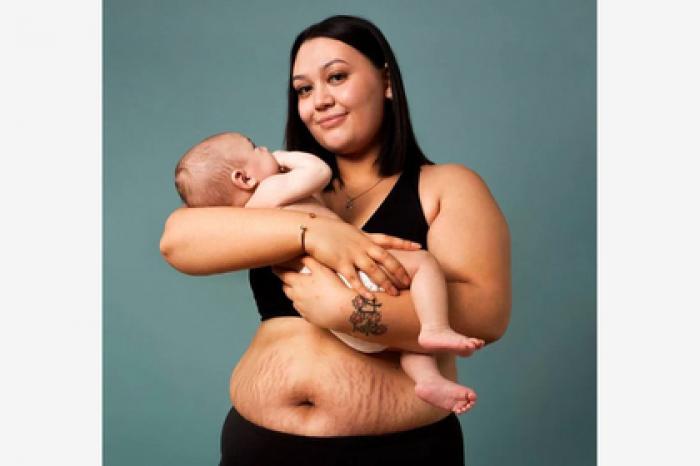 Пополневшие кормящие матери со шрамами и растяжками стали героинями рекламы
