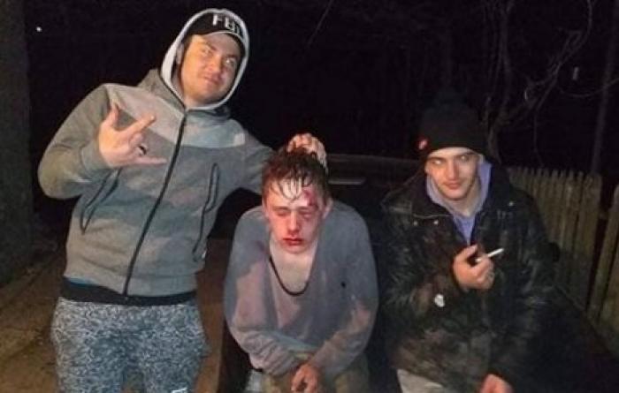 В Чимишлии жестоко избили молодого парня 18+