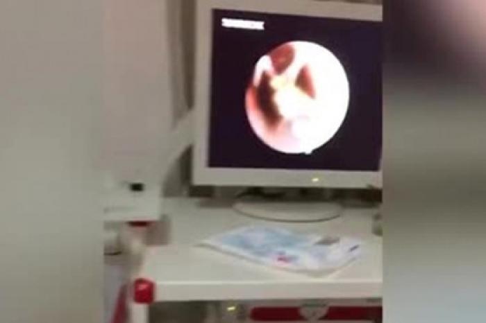 В ухе спящей девушки поселился таракан