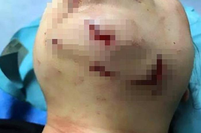 Дайвер-новичок попала в пасть к агрессивной акуле