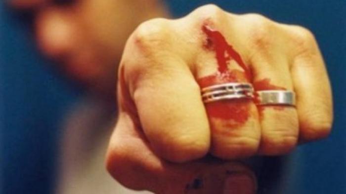 На Ботанике задержали мужчину за хулиганство: патрульным пришлось применить слезоточивый газ