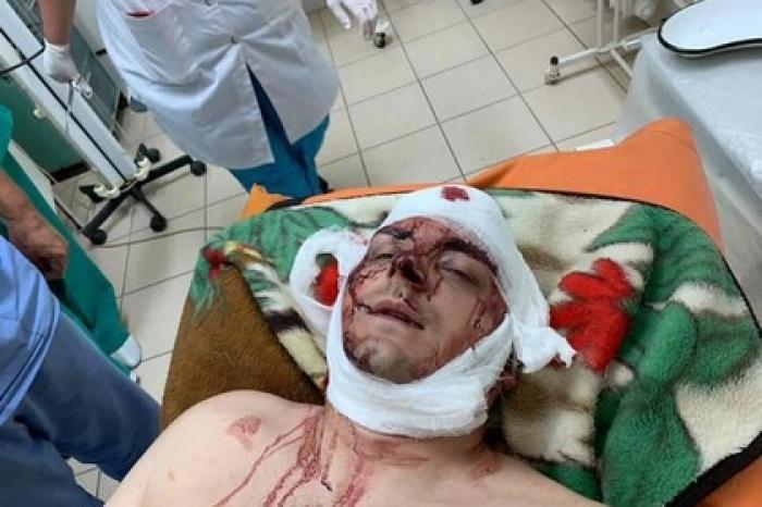На Украине избили скандального бывшего мэра