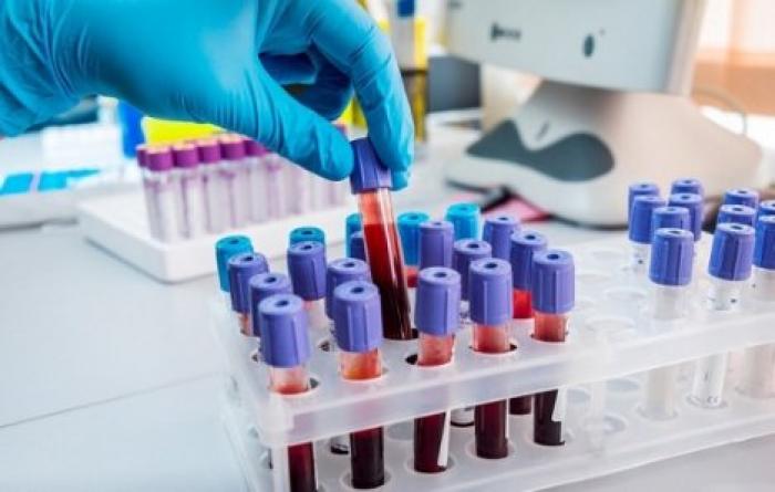 Ученые установили, как группа крови влияет на благополучие человека