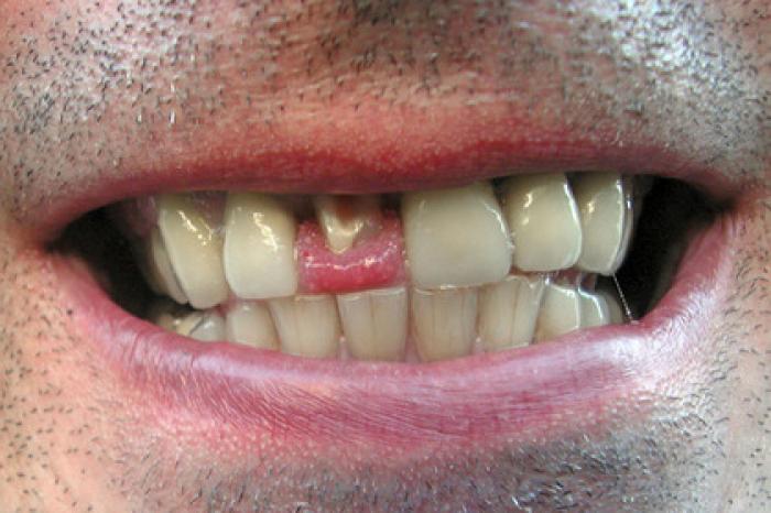 Пассажир поезда отказался показать билет кондуктору и остался без зубов