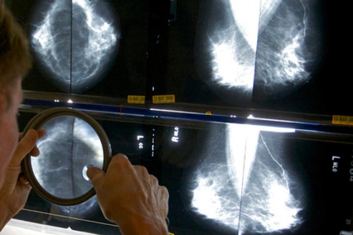 Россиянок обследуют с помощью мобильных маммографов