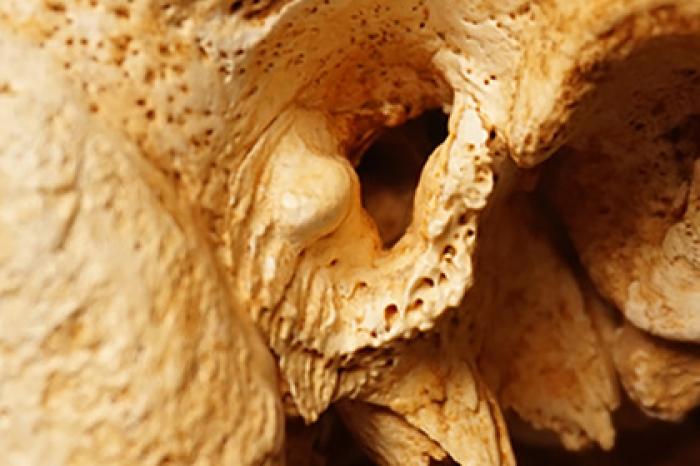 У неандертальцев нашли необъяснимую современную болезнь