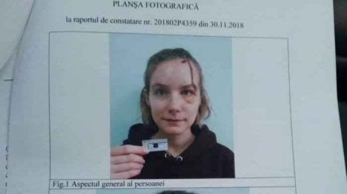 Жительница столицы подала в суд на водителя такси, по вине которого попала в аварию