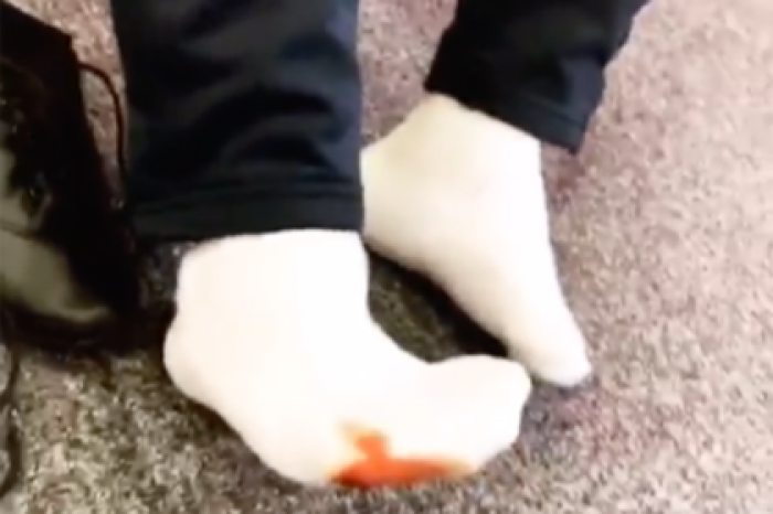 Паралимпиец истек кровью при подготовке к телешоу