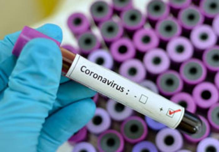 КОЛИЧЕСТВО ИНФИЦИРОВАННЫХ COVID-19 В МОЛДОВЕ ВЫРОСЛО ЗА СУТКИ НА 20%