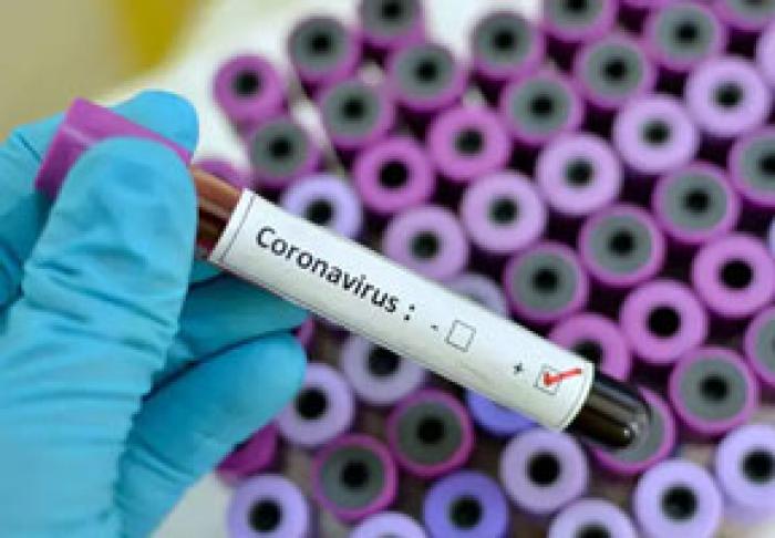МИНЗДРАВ ПОДТВЕРДИЛ ЧЕТВЕРТЫЙ СЛУЧАЙ ЗАРАЖЕНИЯ В МОЛДОВЕ COVID-19, ЕЩЕ 30 - ЖДУТ РЕЗУЛЬТАТОВ АНАЛИЗОВ