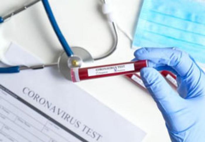 ПРИДНЕСТРОВЬЕ НАПРАВИЛО МОЛДОВЕ РЕКОМЕНДАЦИИ ПО БОРЬБЕ С COVID-19