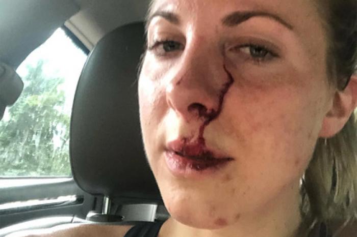 Женщина вышла на пробежку и угодила в лапы громадного медведя