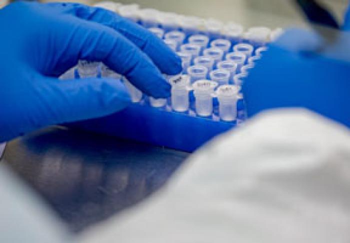 В МОЛДОВЕ ЗАРЕГИСТРИРОВАНО 632 НОВЫХ СЛУЧАЯ ЗАРАЖЕНИЯ КОРОНАВИРУСОМ, ЕЩЕ 12 ЧЕЛОВЕК СКОНЧАЛОСЬ - МИНЗДРАВ