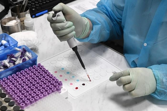 Испытания вакцины Johnson&Johnson возобновятся после смерти добровольца