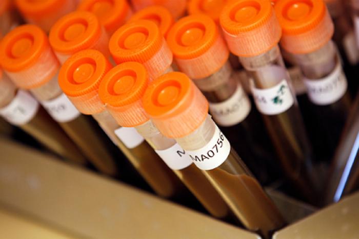 ВОЗ назвала возможную причину пандемии будущего