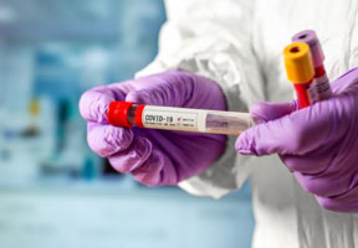 НА ПРОШЛОЙ НЕДЕЛЕ В МОЛДОВЕ ЗАРЕГИСТРИРОВАНО НАИМЕНЬШЕЕ КОЛИЧЕСТВО СЛУЧАЕВ КОРОНАВИРУСА С НАЧАЛА НОЯБРЯ – МИНЗДРАВ