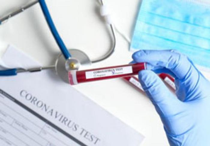 НА ПРОШЛОЙ НЕДЕЛЕ ВПЕРВЫЕ ЗАРЕГИСТРИРОВАНО БОЛЕЕ 10 ТЫСЯЧ НОВЫХ СЛУЧАЕВ ЗАРАЖЕНИЯ КОРОНАВИРУСОМ И БОЛЕЕ 150 СКОНЧАВШИХСЯ