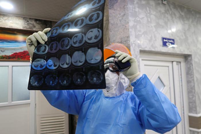 Врач оценил вероятность полного восстановления легких после коронавируса