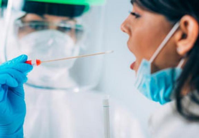 НА ПРОШЛОЙ НЕДЕЛЕ В МОЛДОВЕ ЗАРЕГИСТРИРОВАНО СУЩЕСТВЕННОЕ СОКРАЩЕНИЕ НОВЫХ СЛУЧАЕВ ЗАРАЖЕНИЯ COVID-19 - МИНЗДРАВ