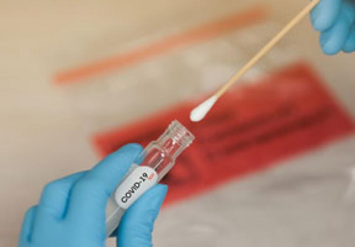 ВО ВТОРНИК В МОЛДОВЕ ЗАРЕГИСТРИРОВАНО 546 НОВЫХ СЛУЧАЕВ ЗАРАЖЕНИЯ COVID-19