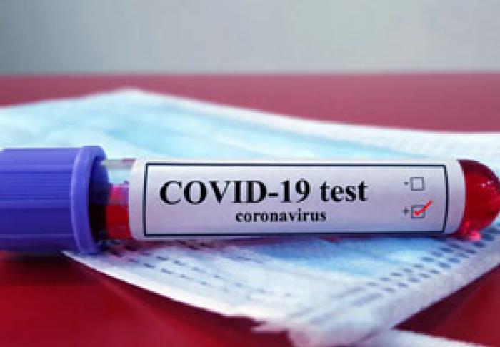 В ПЕРИОД НОВОГОДНИХ И РОЖДЕСТВЕНСКИХ ПРАЗДНИКОВ ЗАРЕГИСТРИРОВАНО СУЩЕСТВЕННОЕ СОКРАЩЕНИЕ СЛУЧАЕВ COVID-19