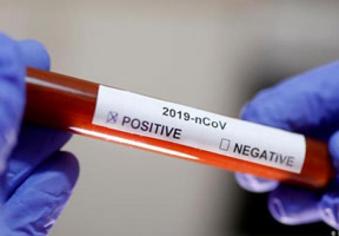 НА ПРОШЛОЙ НЕДЕЛЕ ЗАРЕГИСТРИРОВАНО ПОЧТИ 10 ТЫС. НОВЫХ СЛУЧАЕВ ЗАРАЖЕНИЯ КОРОНАВИРУСОМ – МИНЗДРАВ