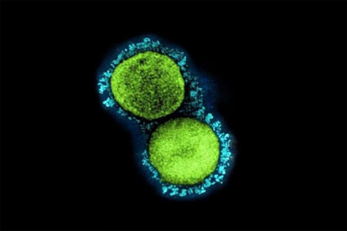 У коронавируса нашли уникальную способность к заражению