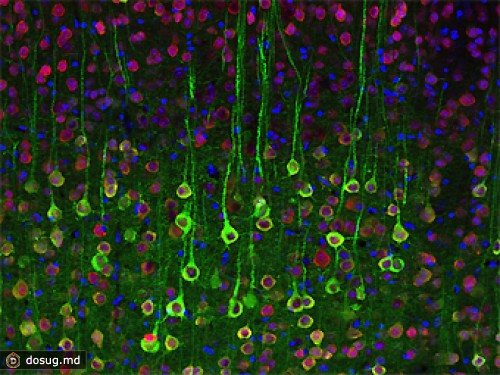 Биологи заставили активные нейроны светиться