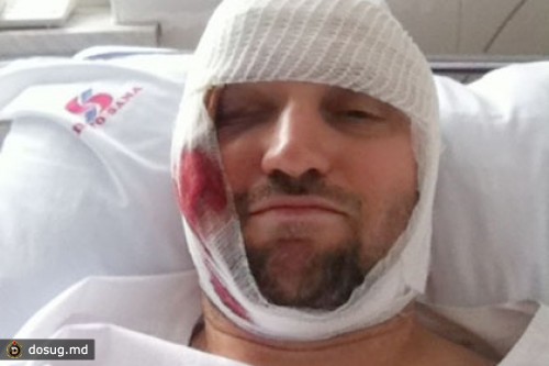 Главного анархиста Украины избили металлической трубой