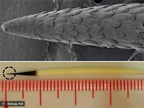 Иглы дикобразов оказались вдвое эффективнее медицинских