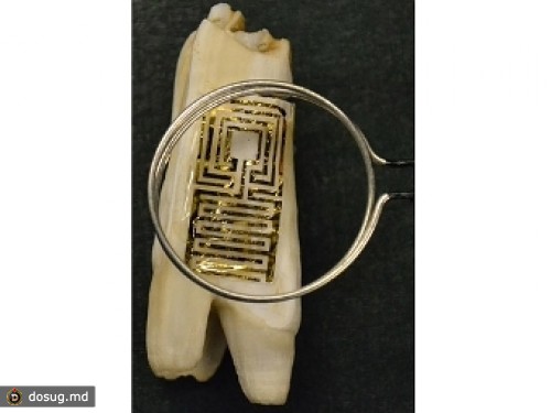 На зубы нанесли беспроводной графеновый детектор бактерий