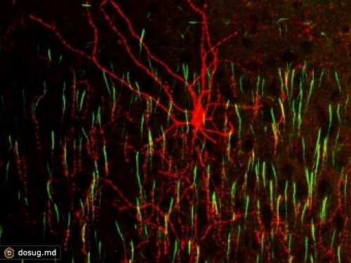 Нейробиологи установили происхождение клеток-канделябров