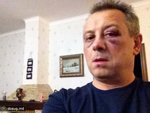 Под Киевом избили депутата от партии "УДАР"