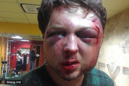 В Киеве избили идеолога FEMEN