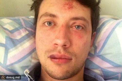 В Подмосковье избили активиста штаба Гудкова