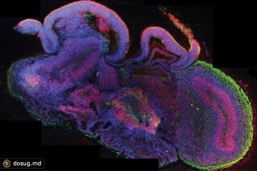 В биореакторе вырастили подобие мозга