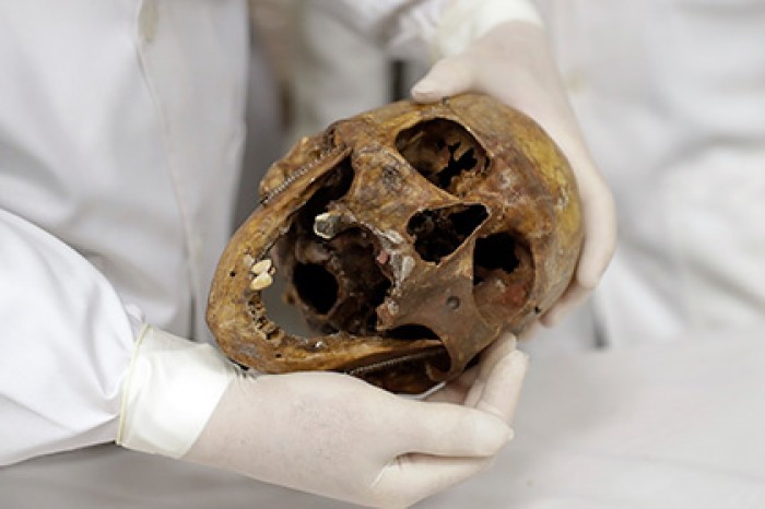 Кости нацистского Ангела Смерти превратили в пособие для студентов